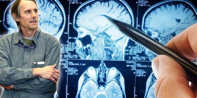 ZAŠTO NAM OVO NE GOVORE LIJEČNICI? Poznati neuroznanstvenik otkriva kako post može izliječiti bilo koju bolest